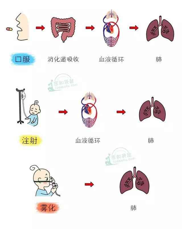 解开迷雾:雾化比输液伤害大系谣言!